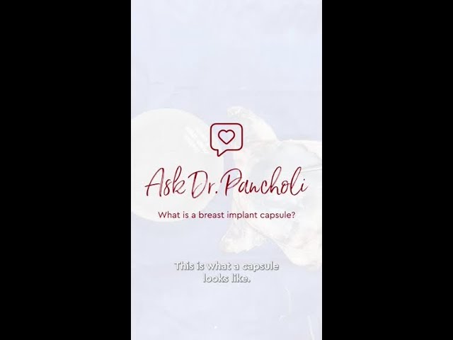 What is a breast implant capsule? Dr. Pancholi freed an implant from capsular contracture