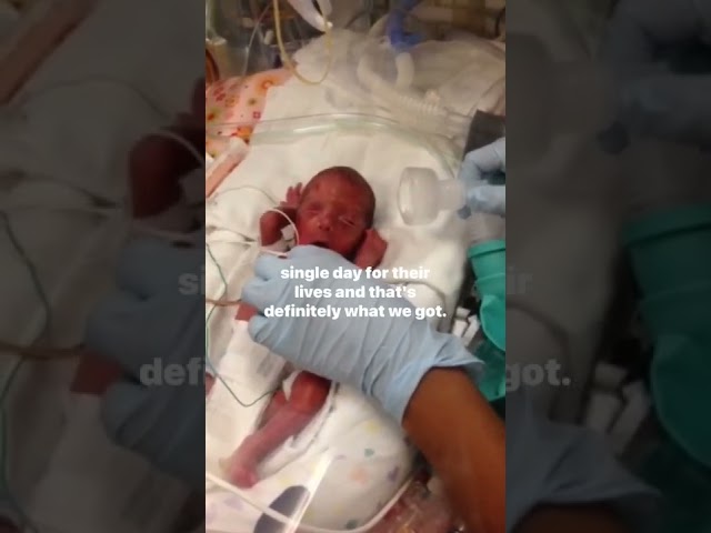 How to Support #Prematurity Awareness #nicu #nicubaby