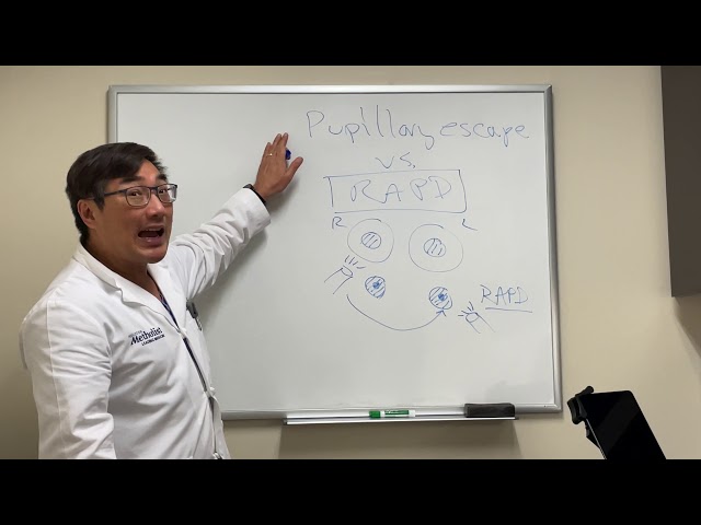 RAPD vs pupillary escape