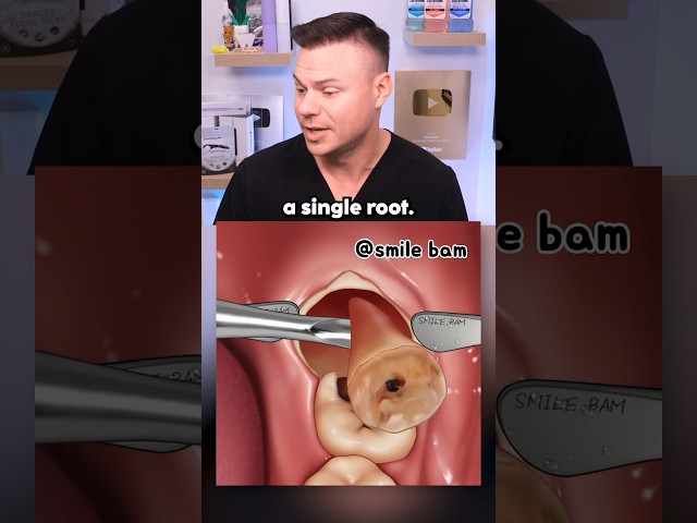 What REALLY Happens During Wisdom Teeth Removal! 🦷😯