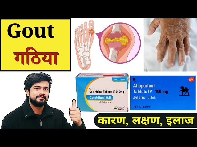 Gout - गठिया | Cause | Types | Treatment | Medicine | Gout Pain | Symptoms | Nursing | Pharmacy