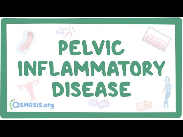Pelvic inflammatory disease - causes, symptoms, diagnosis, treatment, pathology