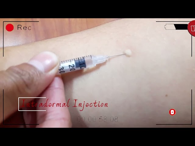 Intradermal Injection
