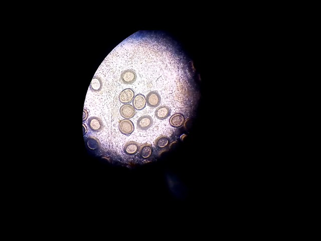 Taenia (tapeworm) eggs under microscope