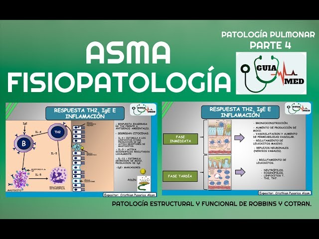 BRONCHIAL ASTHMA PATHOPHYSIOLOGY | GuiaMed