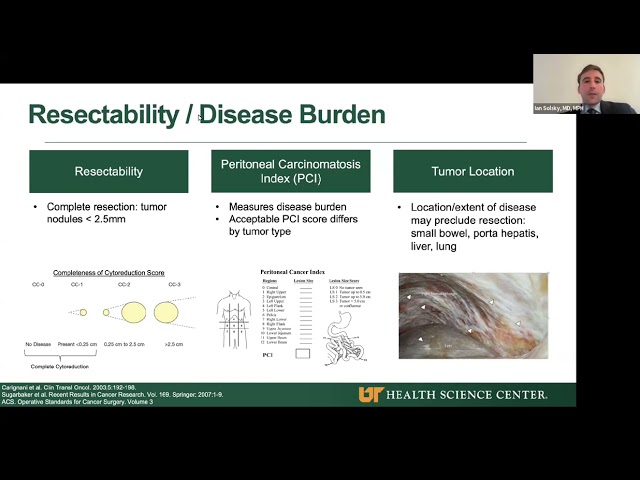 Overview of HIPEC for Nurses and APPs | Ian Solsky, MD, MPH
