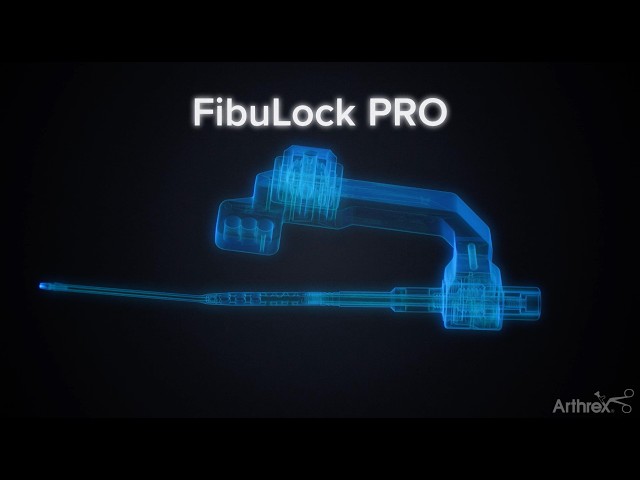 FibuLock® PRO Fibular Nail Features and Benefits Animation