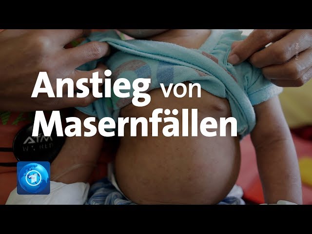 UNICEF empfiehlt Impfung gegen Erkrankung
