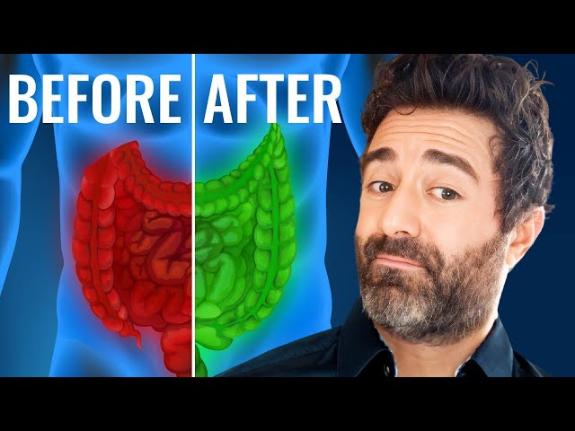 6 Fermented Foods You Must Eat for Better Gut Health