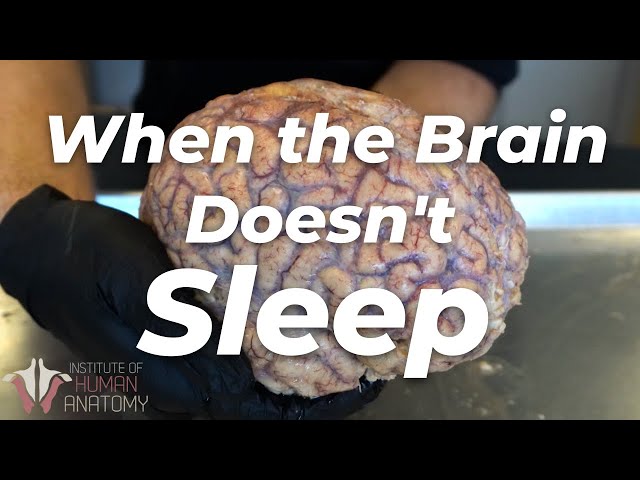 Why Sleep Is Important | Institute of Human Anatomy