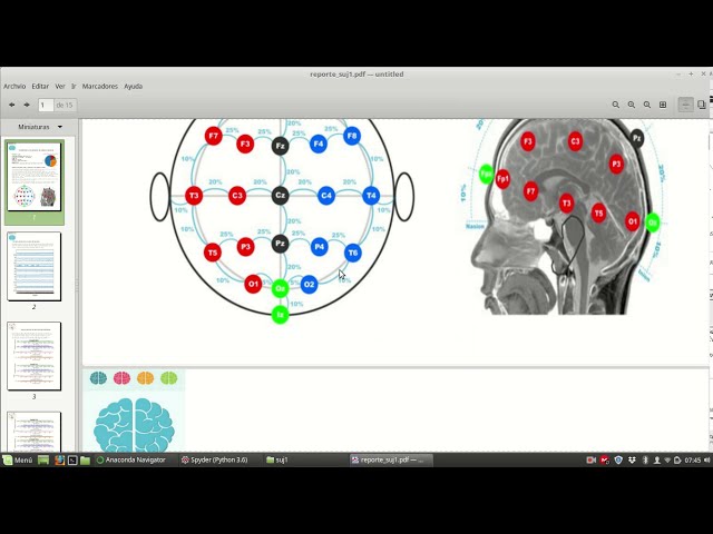 Clasificador EEG signals