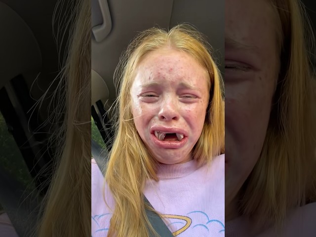 Why Getting Wisdom Teeth Removed Can Get You In TROUBLE!