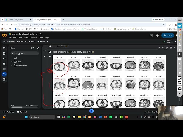 #39 [ Project ] Denoising Brain Tumor using Stacked and Convolutional AutoEncoders