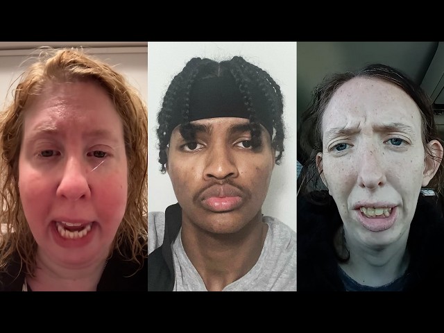 being ugly is worse than death
