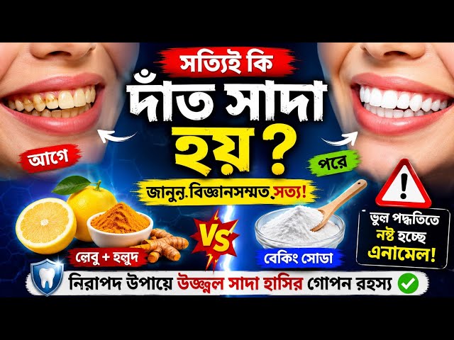 Are You Making Mistakes While Whitening Your Teeth? Science Behind White Teeth #ToothWhitening #W...