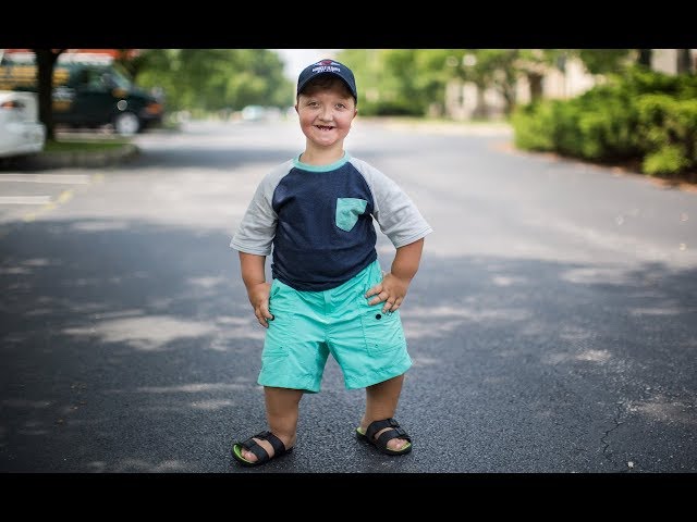 My Dwarfism Is One In A Million | BORN DIFFERENT