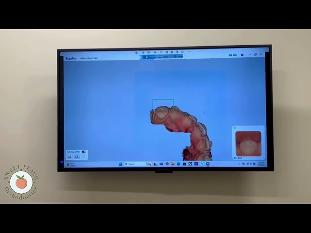 Inside Sweet Peach Orthodontics Smile Tech in Action