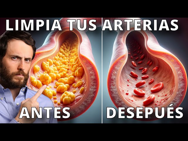 Haz Esto para Destapar tus Arterias y Corregir tu Colesterol