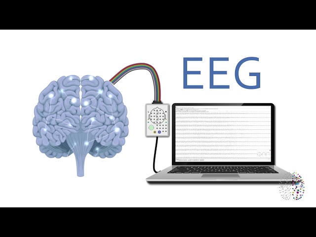 QEEG Brain Scans Explained