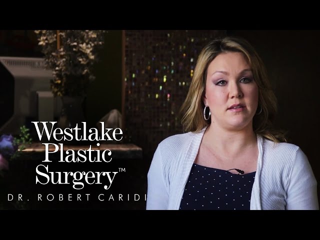 Breast Augmentation and Reduction in Austin  - New Procedure with Dr. Robert Caridi