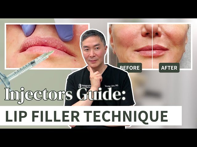 How to Create Beautiful Lips With Dermal Fillers | Injector’s Guide