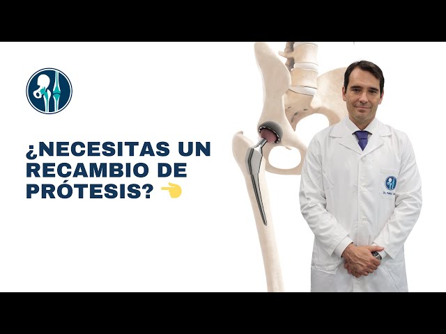 🔹 Recambio de Prótesis de Cadera: ¿Cuándo y Cómo se Realiza? 🔹
