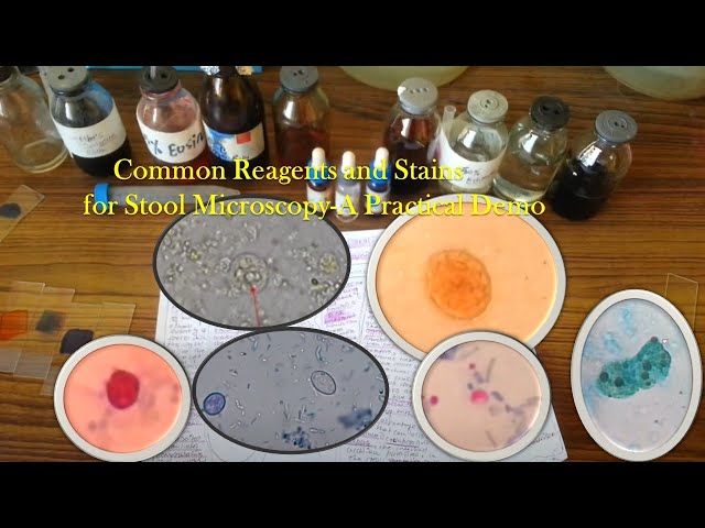 Common Reagents and Stains for Stool Microscopy-A Practical Demo