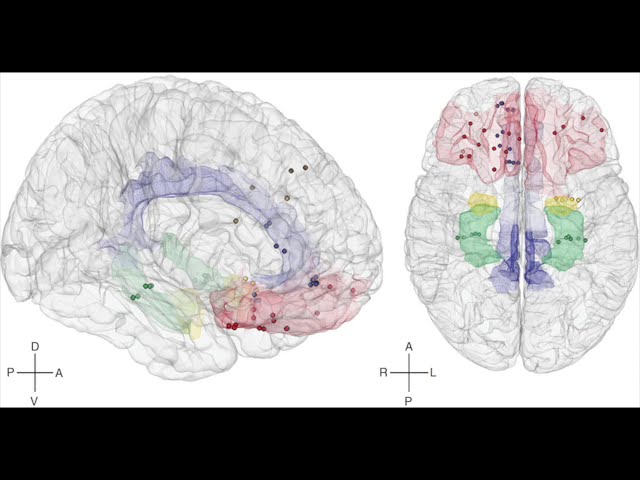 NC State Computer Scientists Reverse Engineering the Human Brain
