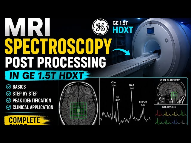 MRI Spectroscopy Post Processing in GE HDXT 1.5T