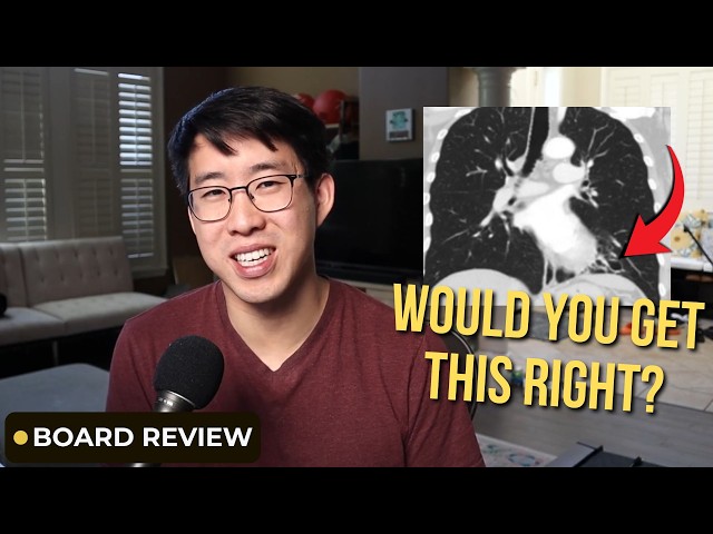 How To Think Through Board Questions Like An Attending