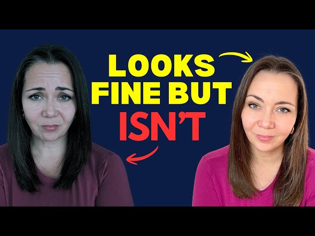 The Hidden Reality of High Functioning Anxiety