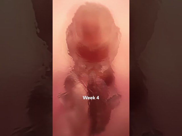 Abortion Kills A Human Life