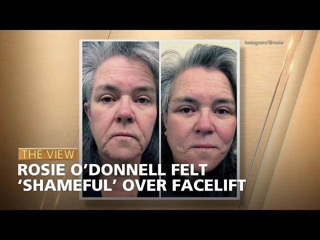 Rosie O’Donnell Felt ‘Shameful’ Over Facelift | The View