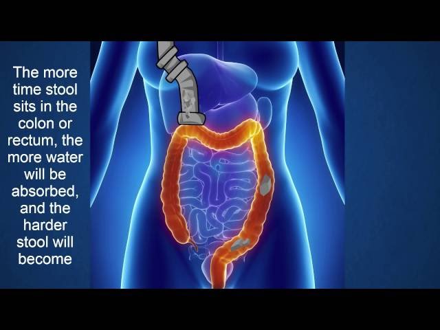 Constipation: what is it? who gets it? how is it prevented and treated?