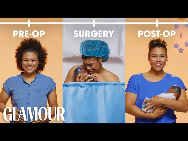 This is Your C-Section in 2 Minutes | Glamour