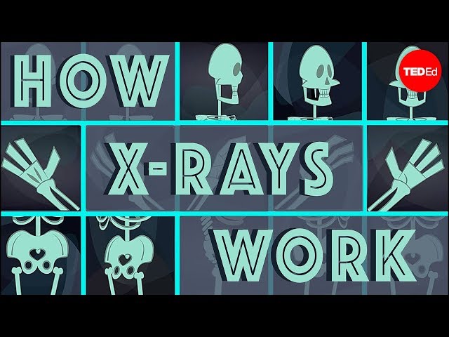 How X-rays see through your skin - Ge Wang