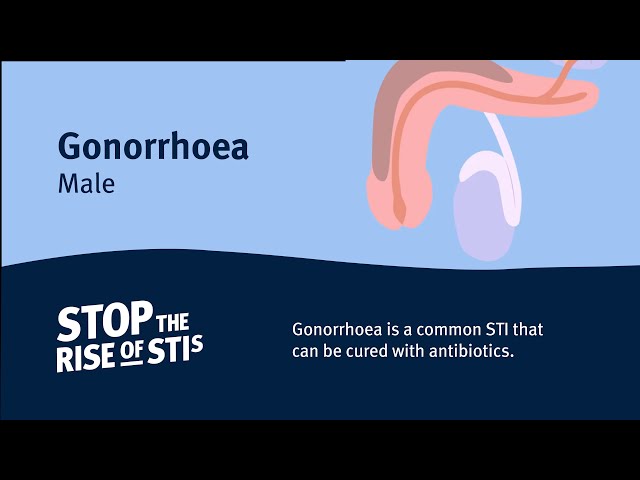 Sexual Health - Gonorrhoea (Male)