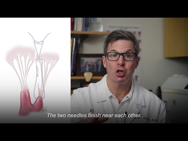 Demystifying Mitral Valve Repair