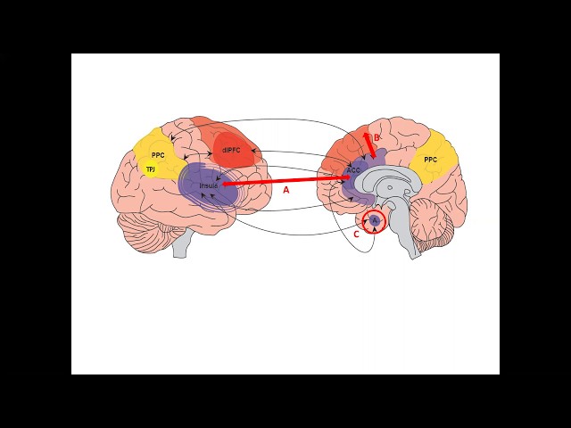 Dr David Perez -World FND Week 2019