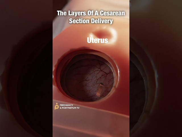 Layers of C-Section Delivery ✨FASCINATING✨ #shorts