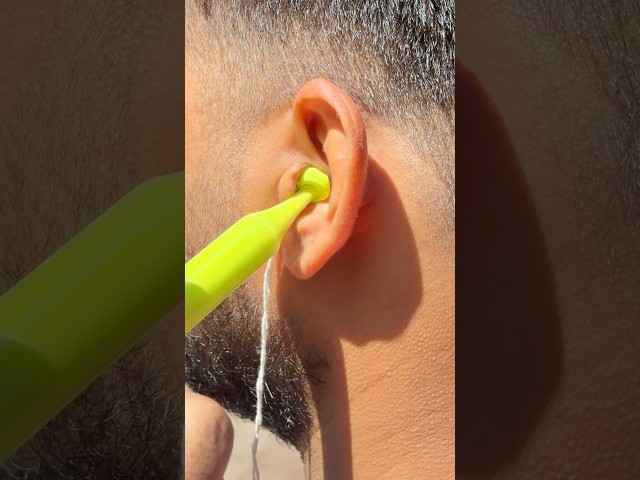 How We Take an Ear Impression for an Oticon Hearing Aid | IIC, CIC & Bluetooth CIC Devices. #oticon