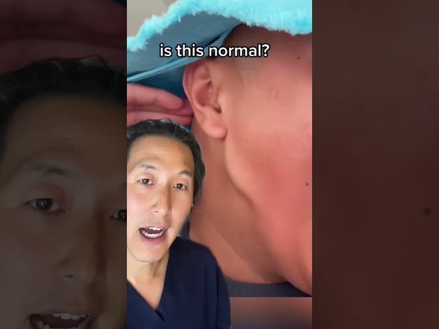 How Do You Fix This Jawline Filler Gone Wrong? #shorts #fillers