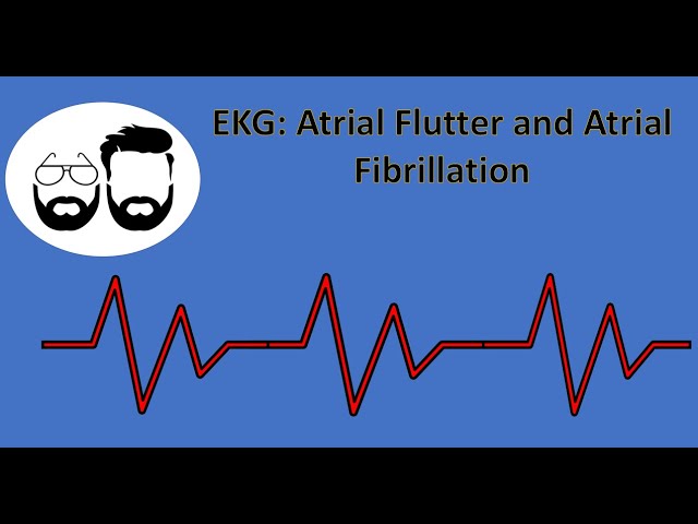 EKG Series: Atrial Flutter (a-flutter) and Atrial Fibrillation (a-fib)