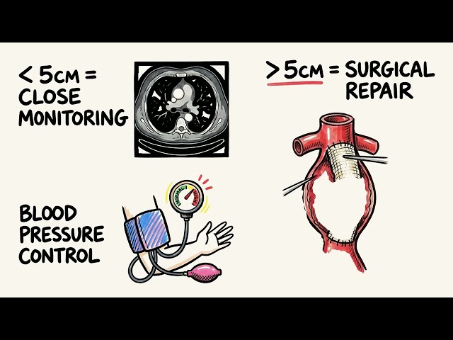 Case Study AORTIC ANEURYSM