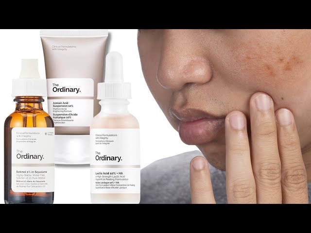 Top 5 Ordinary Skincare For Hyperpigmentation And How To Layer Them | Dermapedia