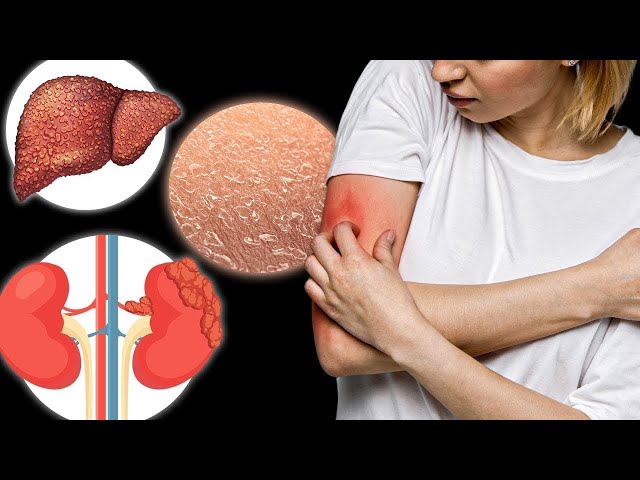 The 15 Causes of ITCHING You've Never Heard About