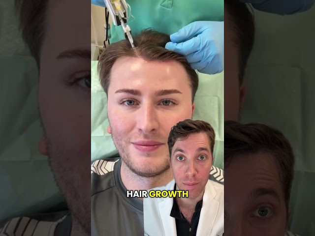 Considering PRP for Hair Loss?