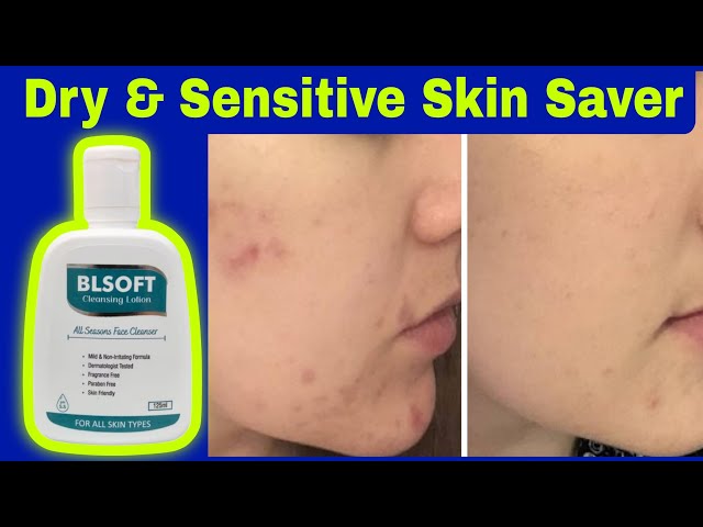 Blsoft Face Cleanser Lotion Review | Benefits, Usage & Honest Experience | Glowing Skin Tips#skin