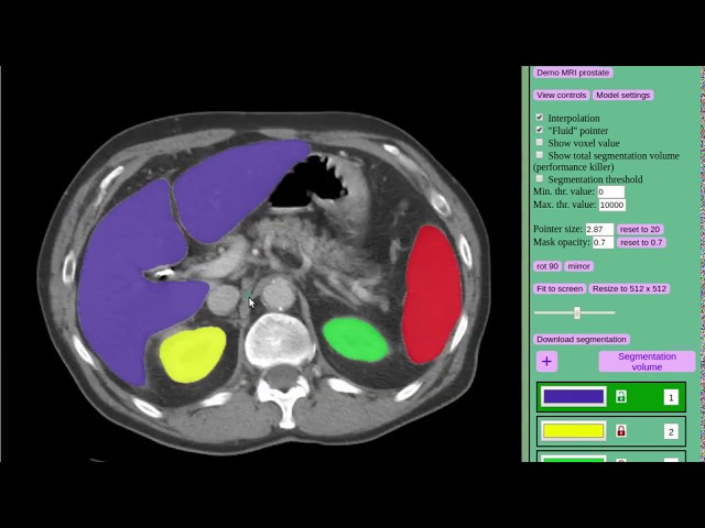 Segmenting abdominal organs with MedSeg