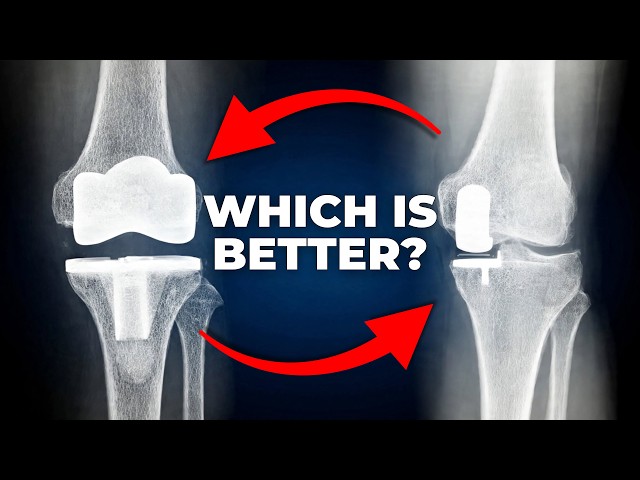 Partial vs Total Knee Replacement: Which One Fits Your Knee?